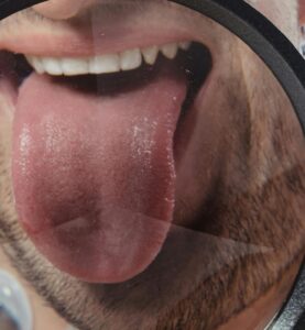 Tongue